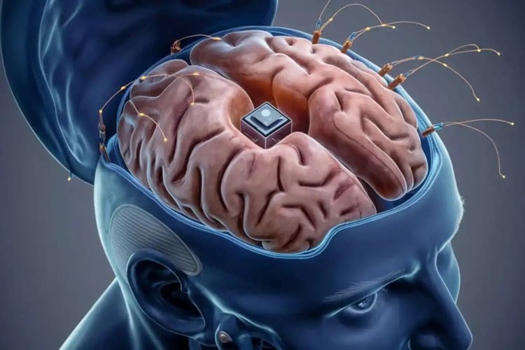 تراشهای که با کمک هوش مصنوعی میتواند حافظه آسیبدیدگان مغزی را تقویت کند