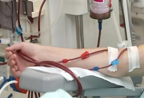 دو دستگاه دیالیز تازه برای سیرجان؛ گلگهر حمایت از سلامت را ادامه داد