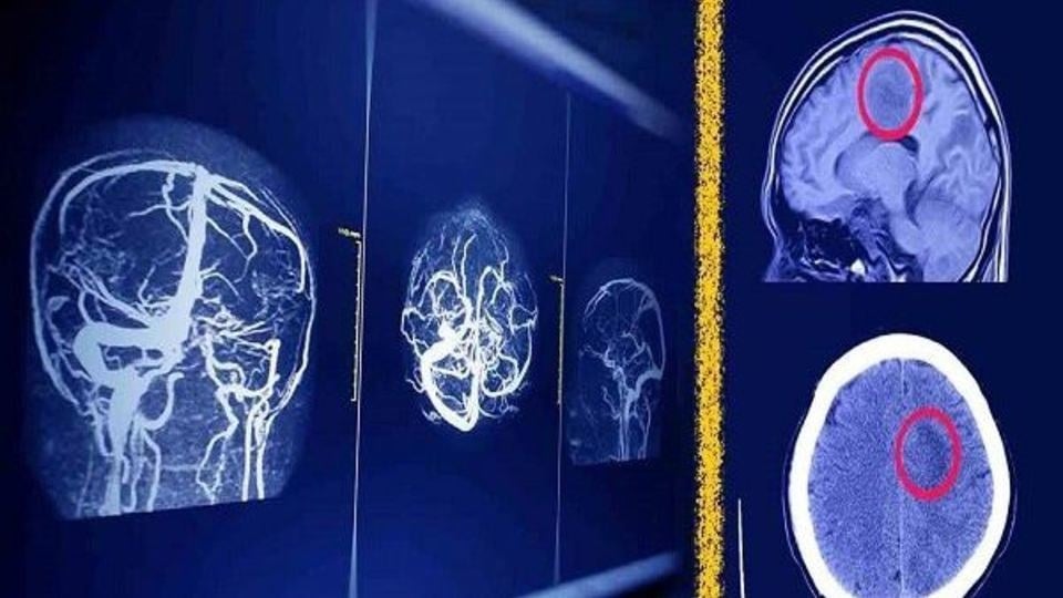 پیش بینی آینده رادیولوژیست‌ها باوجود هوش مصنوعی
