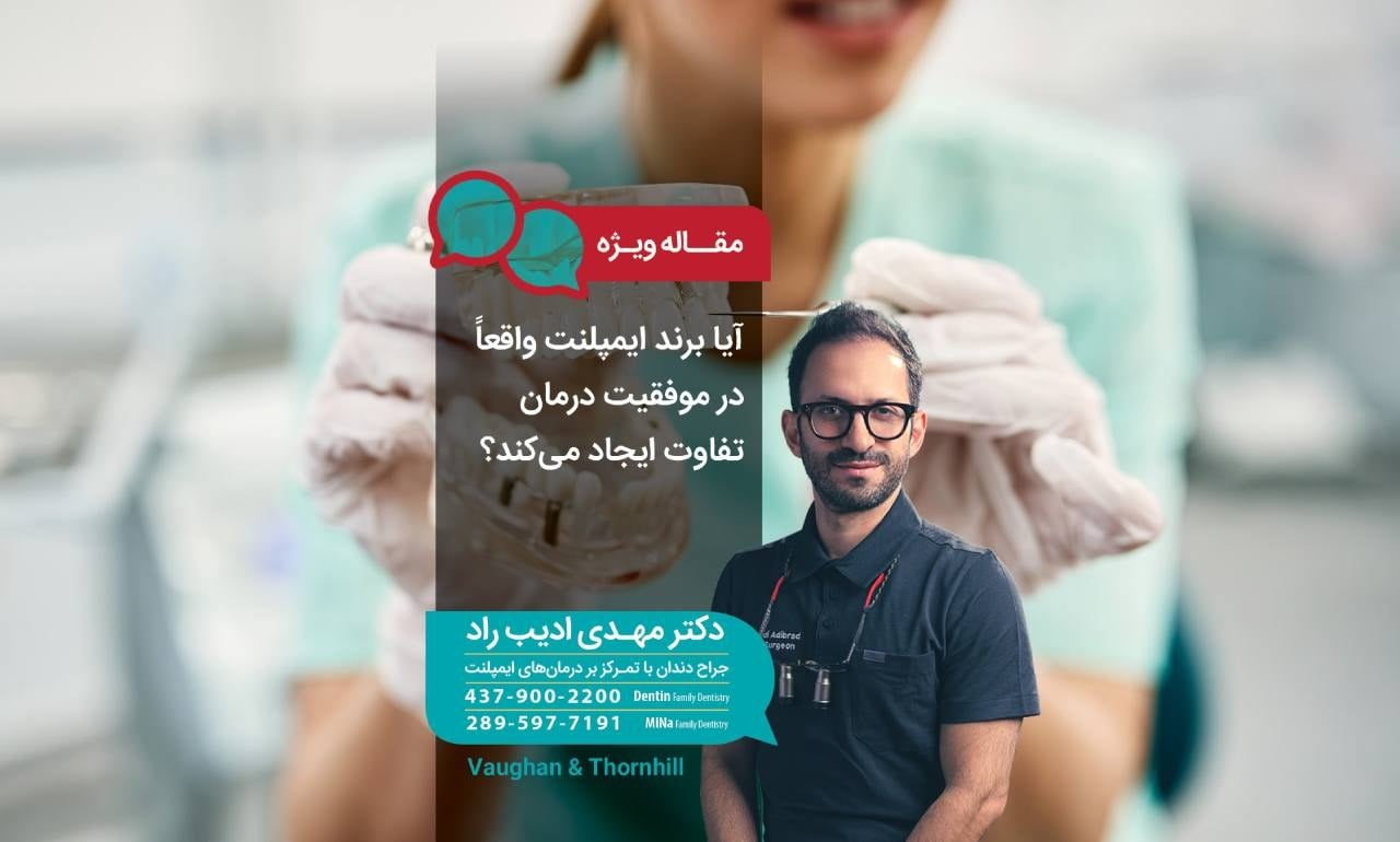 آیا برند ایمپلنت واقعاً در موفقیت درمان تفاوت ایجاد می‌کند؟