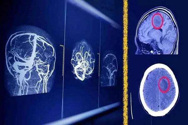 پیش بینی آینده رادیولوژیستها باوجود هوش مصنوعی