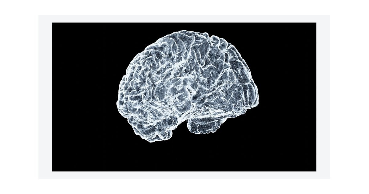همکاری انویدیا و C-BRAIN برای مهار دادههای پنهان پژوهش آلزایمر با هوش مصنوعی متنباز