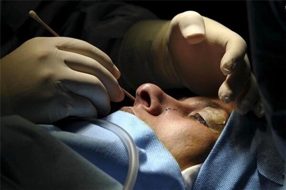 هشدار مجلس به پزشکان درباره تبلیغات غیرمجاز پزشکی و زیبایی؛ مجازات‌ها تشدید می‌شود